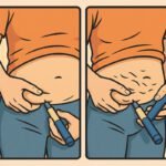 Eine Person injiziert Insulin zur Blutzuckerkontrolle, um Diabetes besser zu managen. | © Lipothrophien-Klein